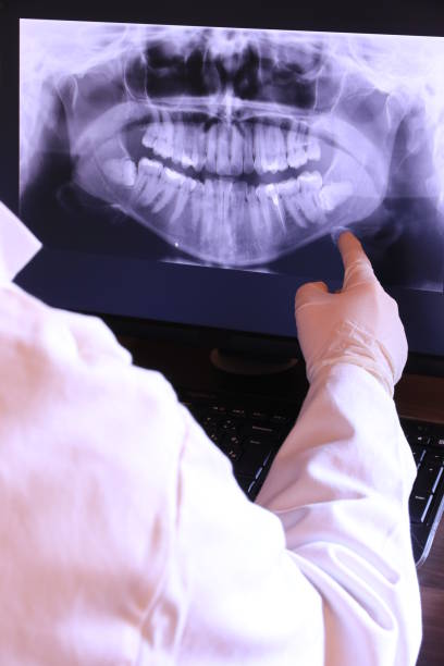 Best Emergency Tooth Extraction in Grand Ronde, OR